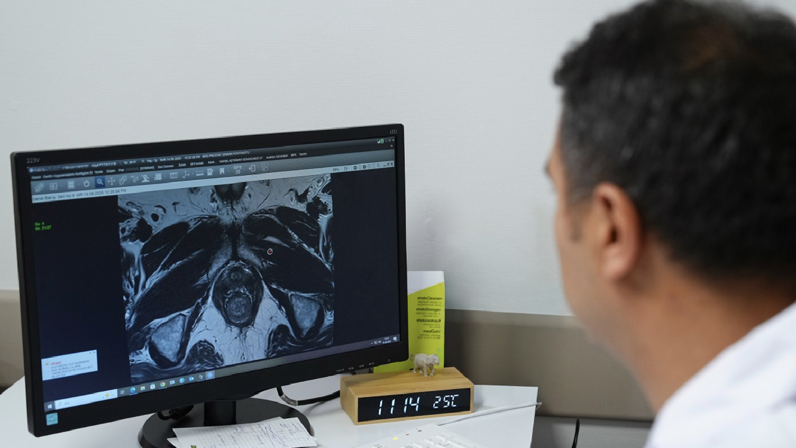 uzmanindan prostat kanserinde dogru tani uyarisi fuzyon biyopsi ile tumor odaklari hedefe yonelik sekilde tespit edilebiliyor CNFQmcdP